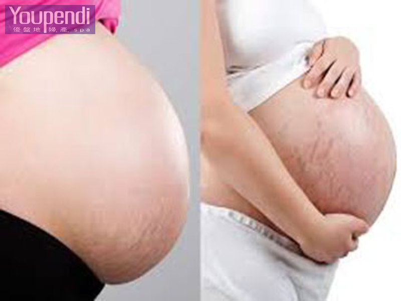 孕婦妊娠緊腹護理 
